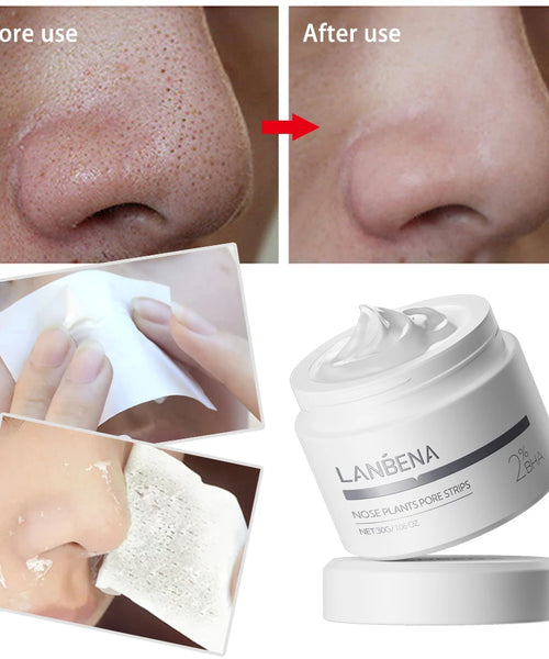 LANBENA Blackhead Remover Nose Mask