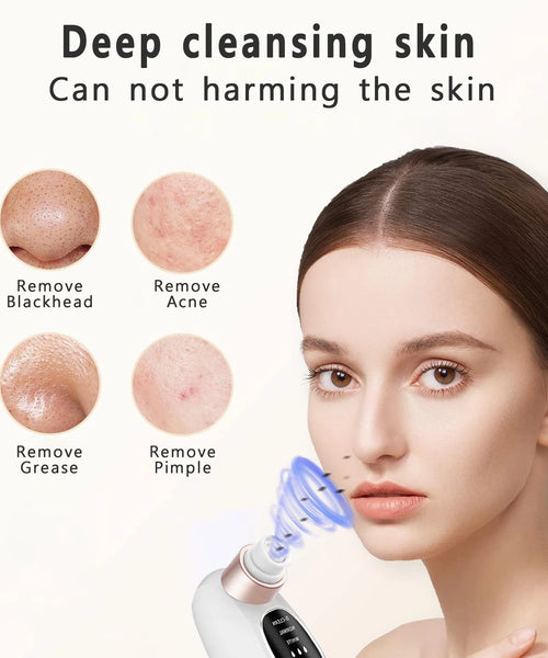 Electric Pore Vacuum – Rechargeable Blackhead Remover with Water Cycle