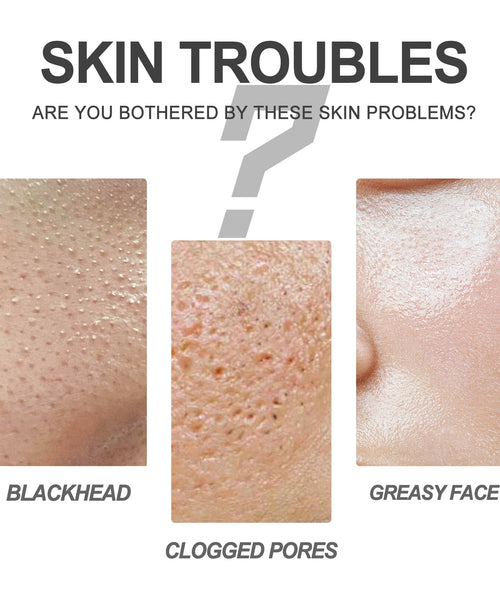 Nose Blackhead Removal Mask