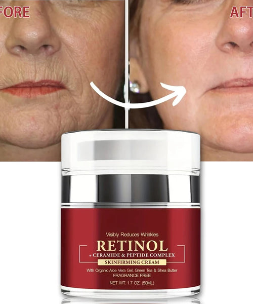 Instant Retinol Cream – Anti-Aging & Firming Korean Skincare