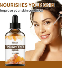 Frankincense Essential Oil – Hydrating Face & Body Care