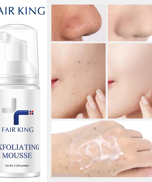 Facial Exfoliating Mousse – Deep Cleansing Peeling Gel for All Skin Types